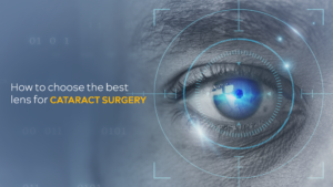 best lens for cataract surgery