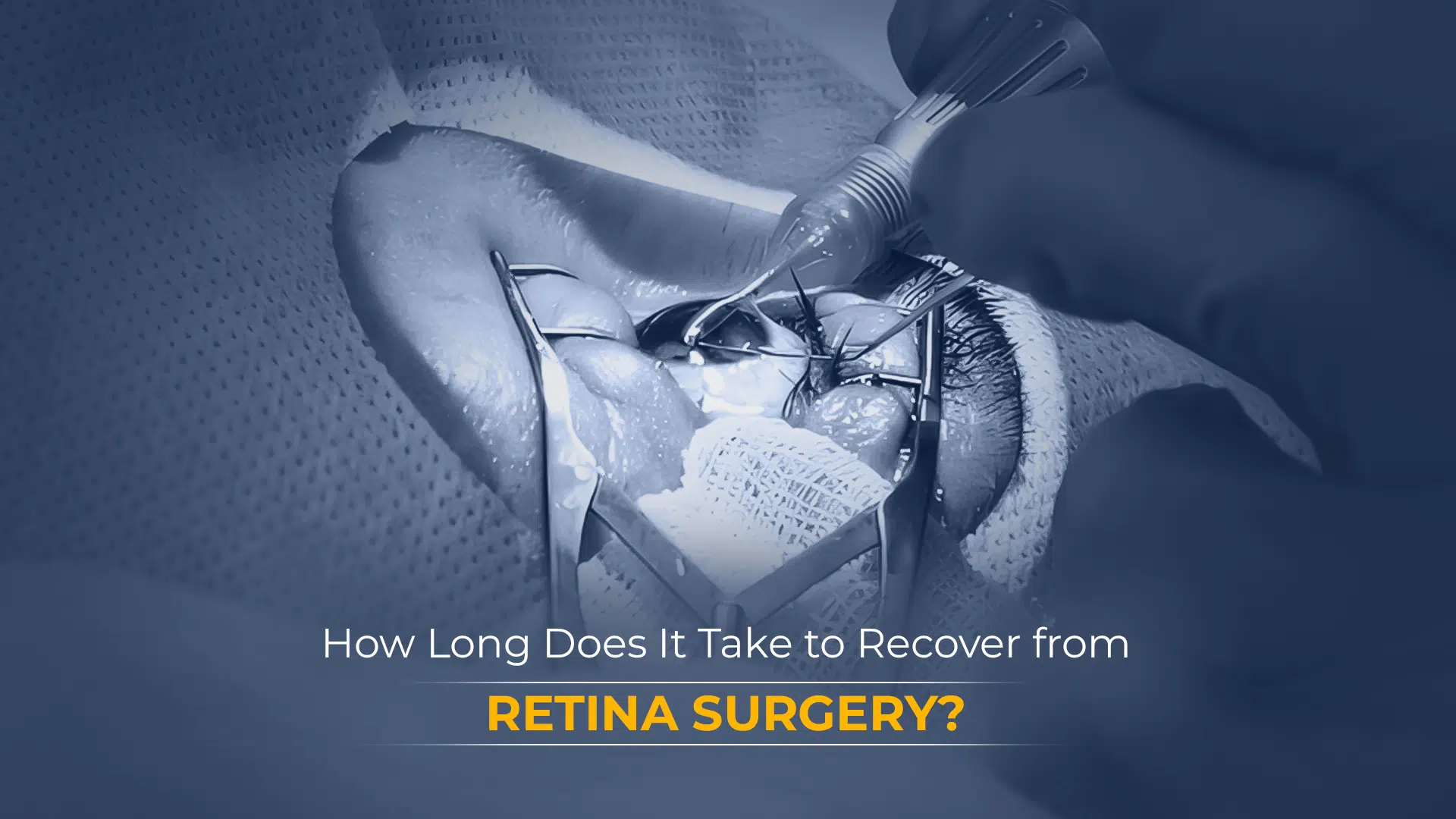 Retina Surgery