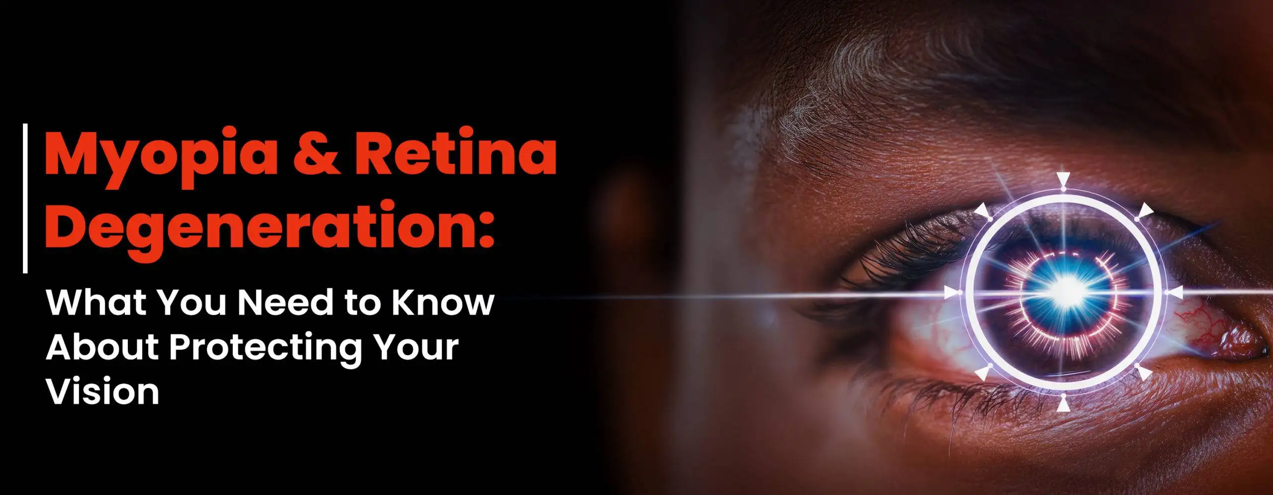 Retina Degeneration