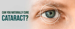 cataract