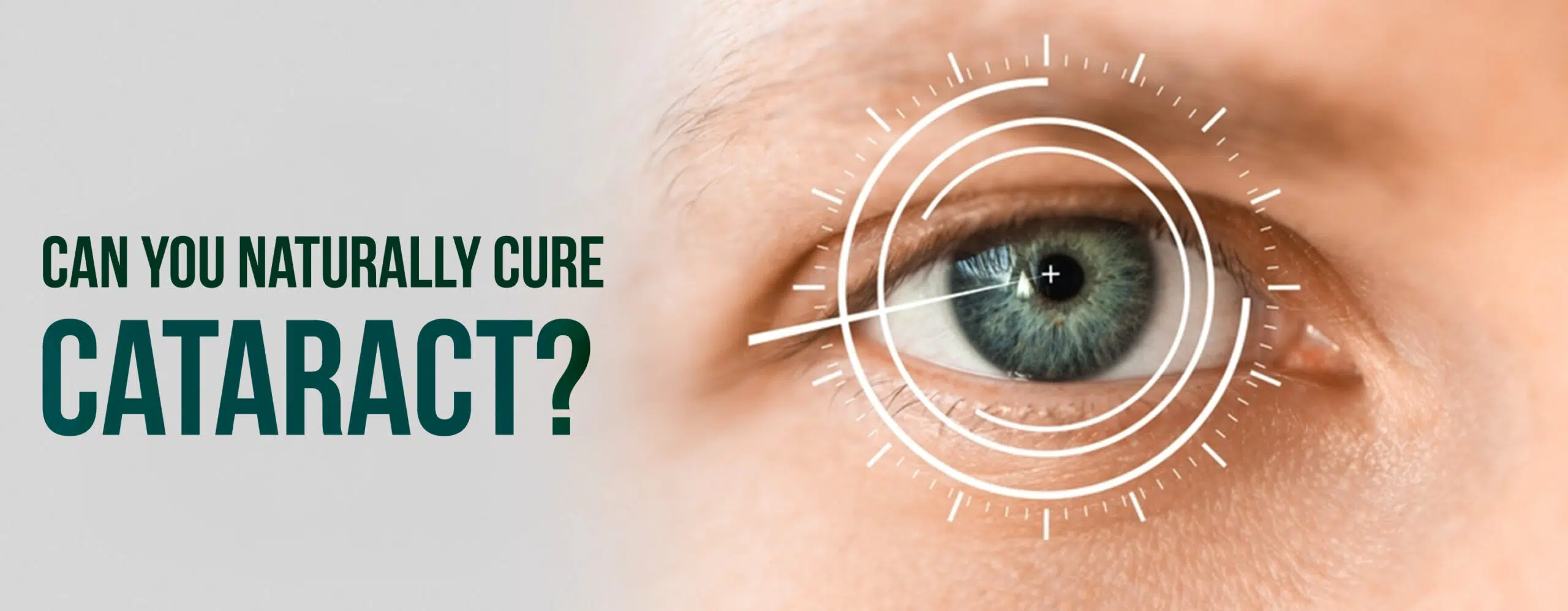 cataract