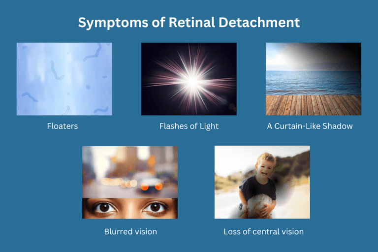 Retina detachment