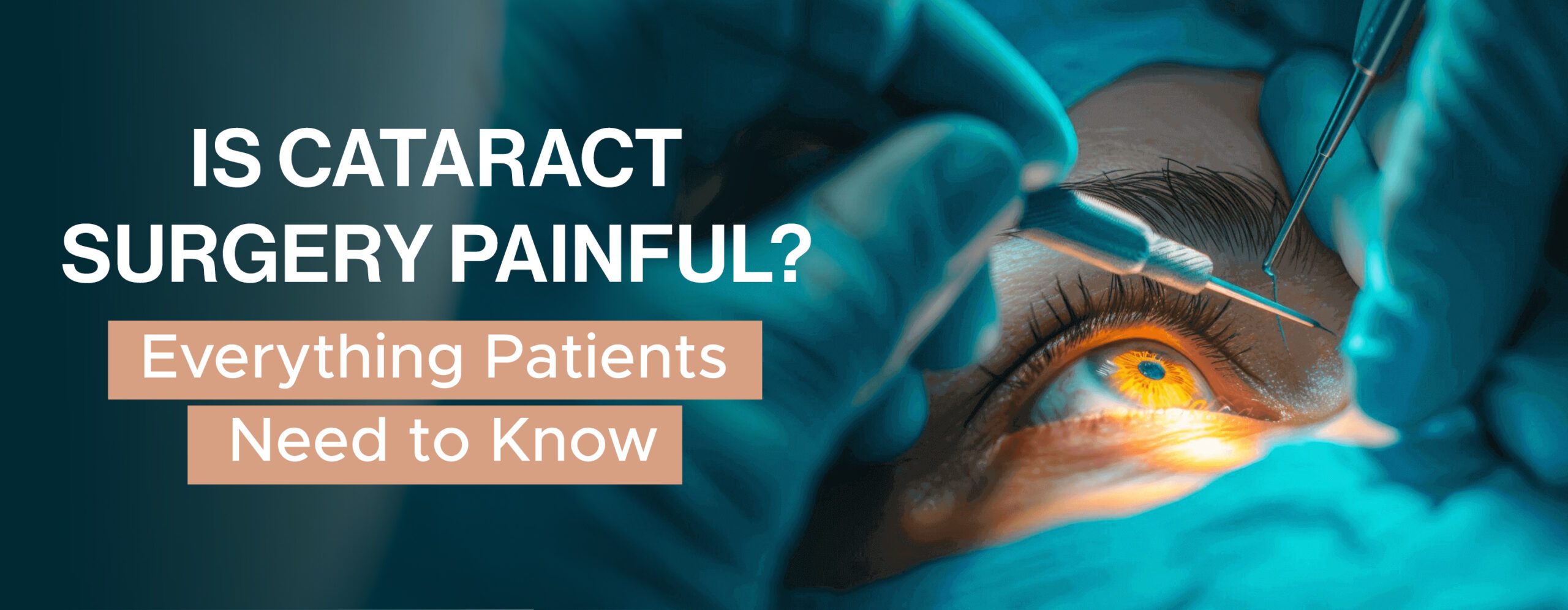 Best Cataract Surgeon in Delhi