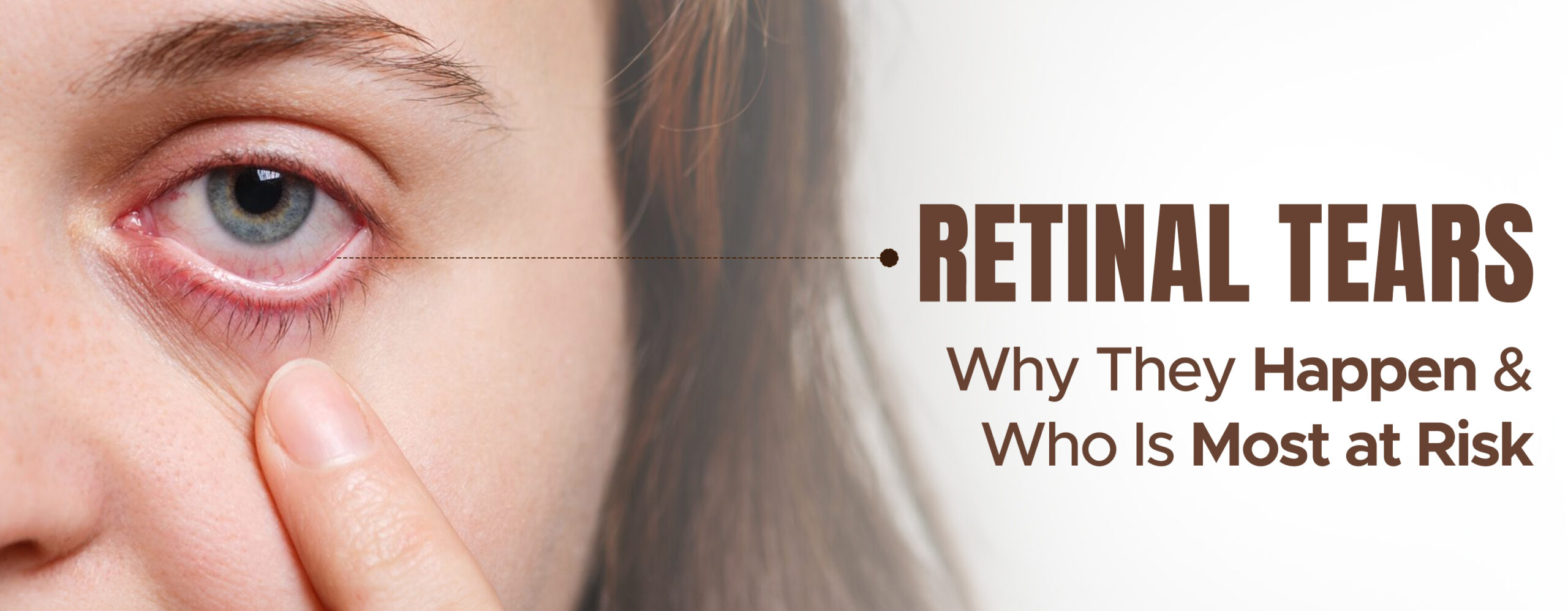 How to cure a retinal tear naturally
