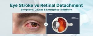 Banner illustrating the difference between an eye stroke and retinal detachment with a close-up of a red eye, a retina cross-section, and information about symptoms, causes, and emergency treatment.