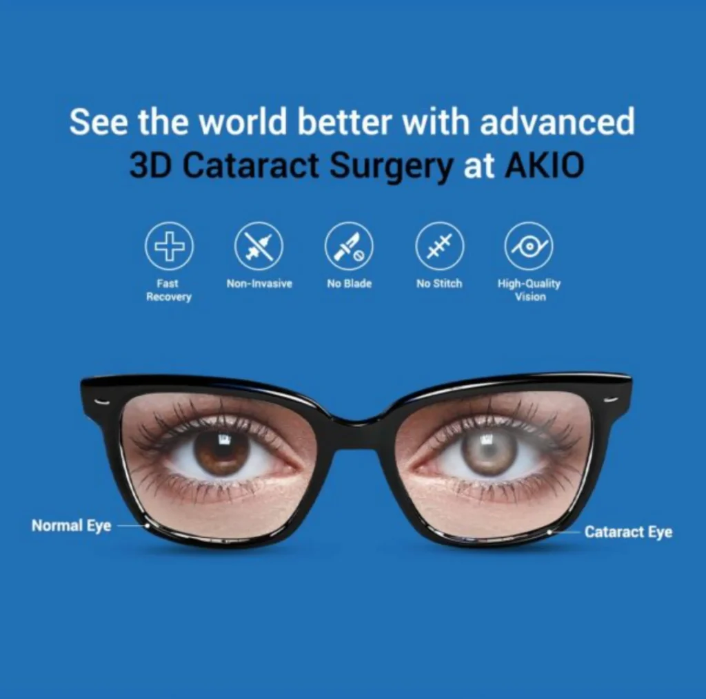 3D Cataract Surgery at AKIO