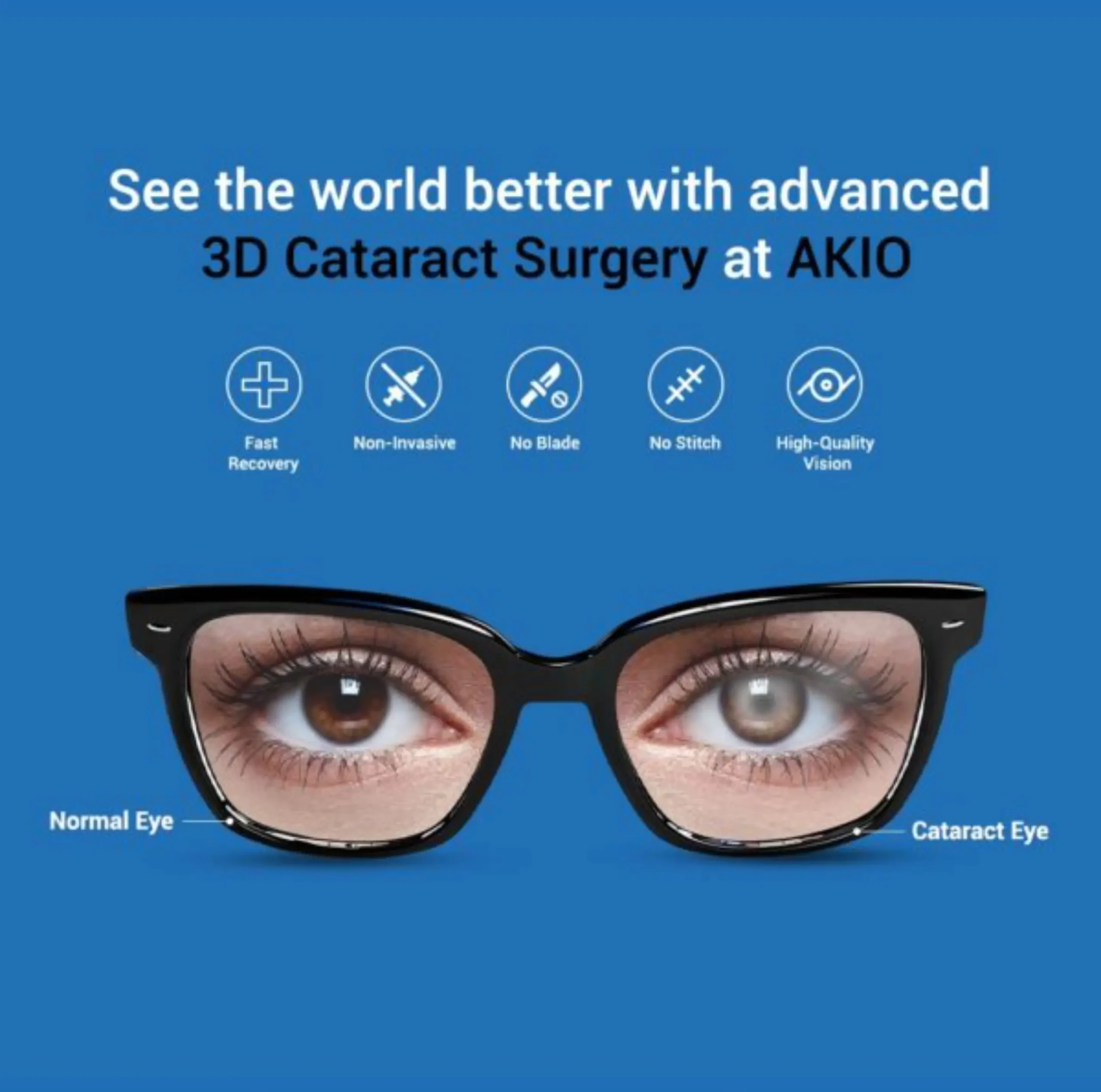 3D Cataract Surgery at AKIO