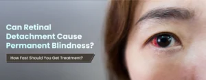 Can Retinal Detachment Cause Permanent Blindness How Fast Should You Get Treatment