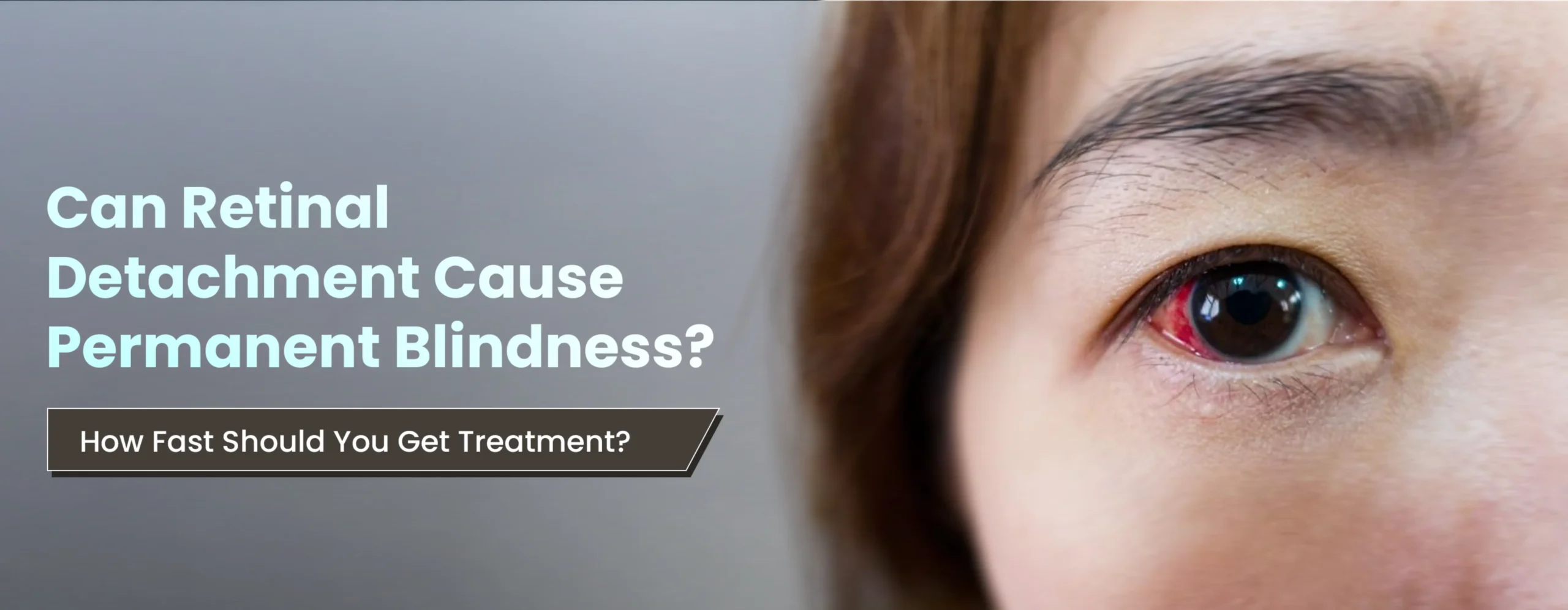 Can Retinal Detachment Cause Permanent Blindness How Fast Should You Get Treatment
