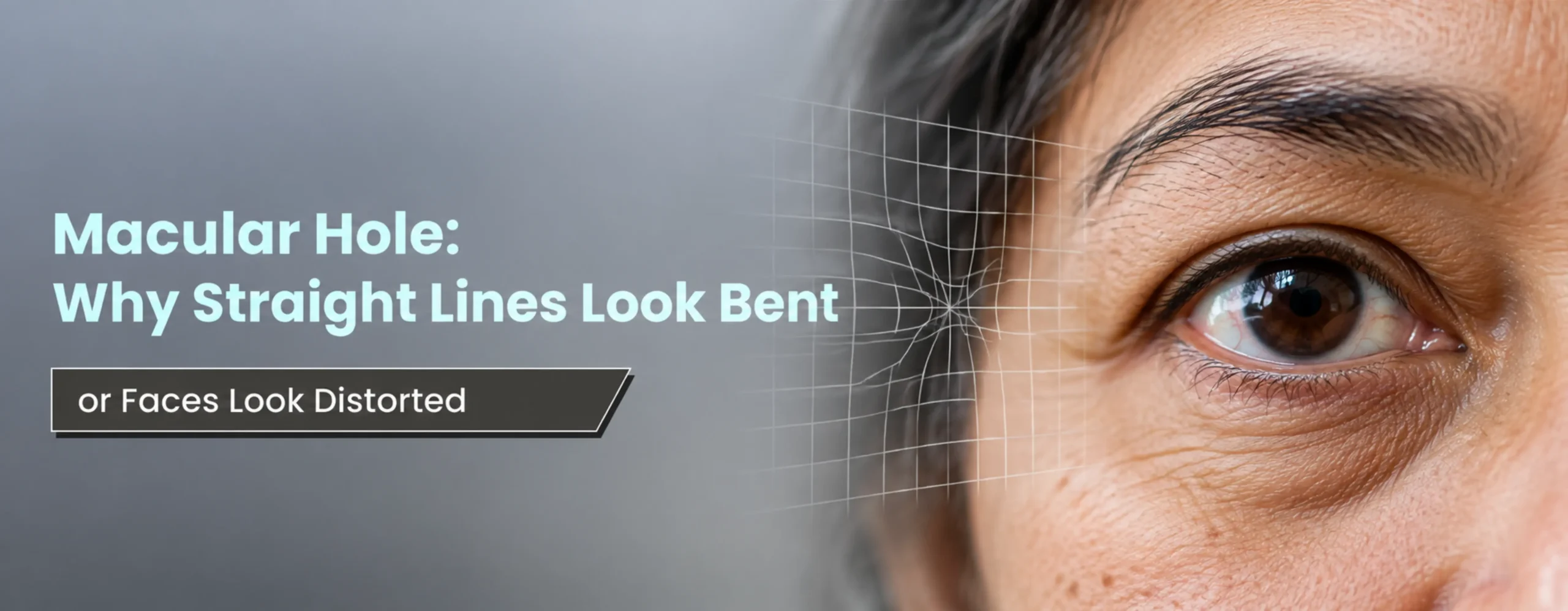 Macular Hole Why Straight Lines Look Bent, or Faces Look Distorted
