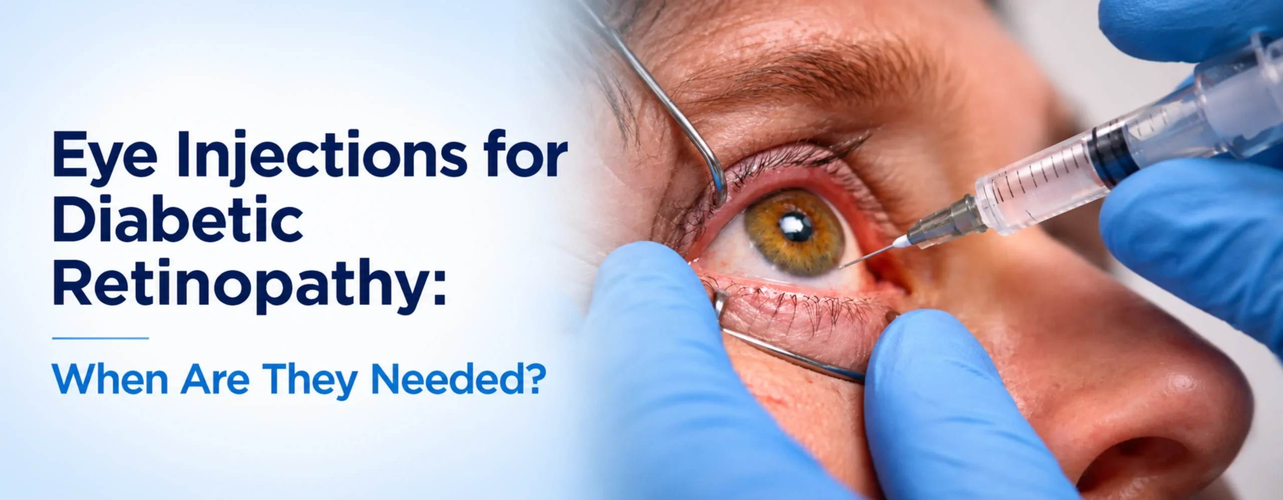 Eye Injections for Diabetic Retinopathy: When Are They Needed?