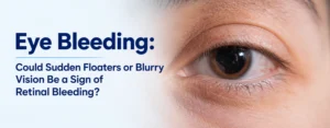 Eye Bleeding: Could Sudden Floaters or Blurry Vision Be a Sign of Retinal Bleeding?