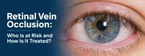 Retinal Vein Occlusion: Who Is at Risk and How Is It Treated?